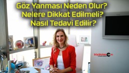 Göz Yanması Neden Olur? Nelere Dikkat Edilmeli? Nasıl Tedavi Edilir?