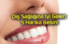 Diş Sağlığına İyi Gelen 5 Harika Besin!