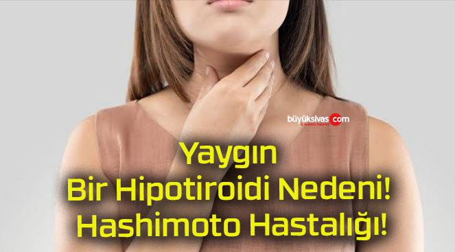 Yaygın Bir Hipotiroidi Nedeni! Hashimoto Hastalığı!