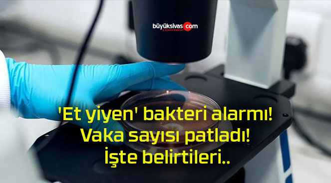 ‘Et yiyen’ bakteri alarmı! Vaka sayısı patladı! İşte belirtileri..