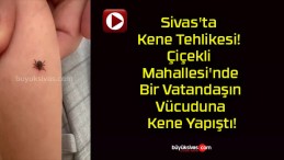 Sivas’ta Kene Tehlikesi! Çiçekli Mahallesi’nde Bir Vatandaşın Vücuduna Kene Yapıştı!