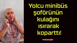 Yolcu minibüs şoförünün kulağını ısırarak koparttı!