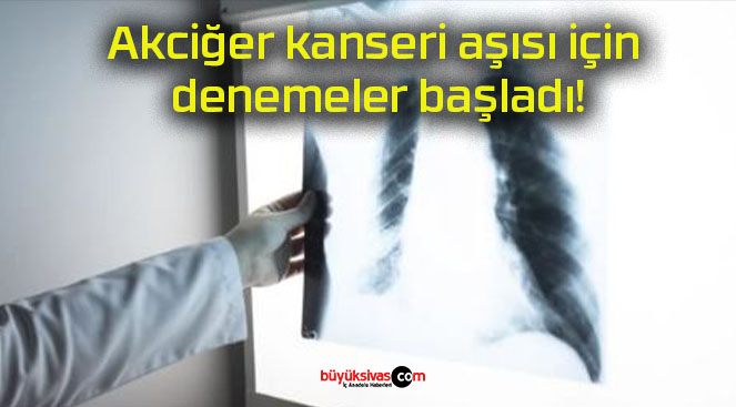 Akciğer kanseri aşısı için denemeler başladı!