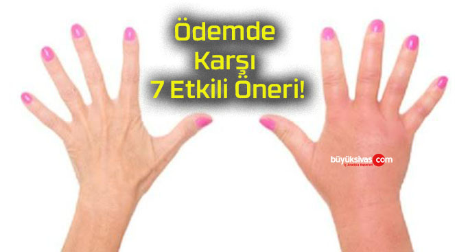 Ödemde Karşı 7 Etkili Öneri!