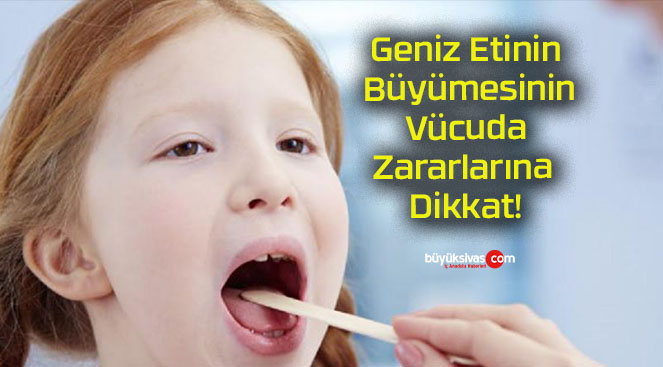 Geniz Etinin Büyümesinin Vücuda Zararlarına Dikkat!