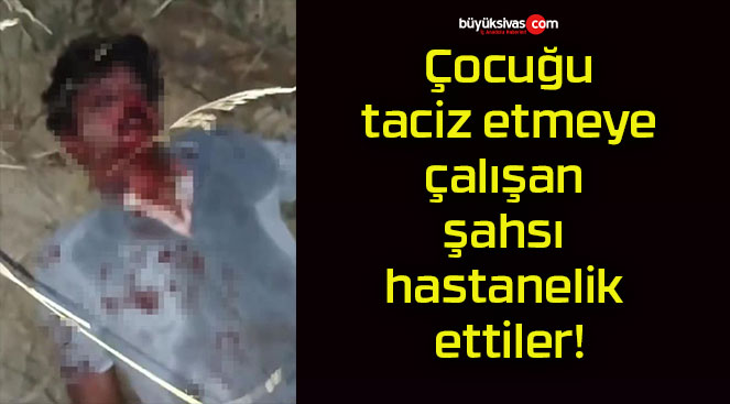 Çocuğu taciz etmeye çalışan şahsı hastanelik ettiler!