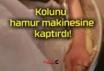 Kolunu hamur makinesine kaptırdı!