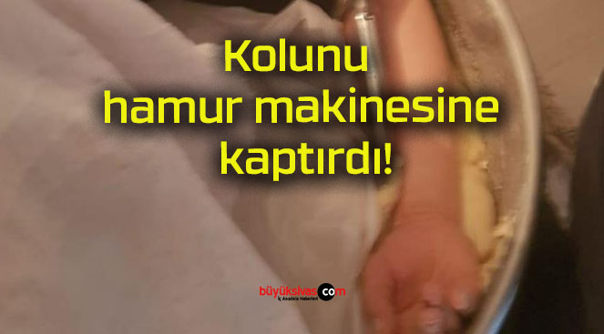 Kolunu hamur makinesine kaptırdı!