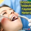 Ortodontik Tedavilerin Faydaları Nelerdir?