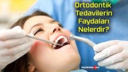 Ortodontik Tedavilerin Faydaları Nelerdir?