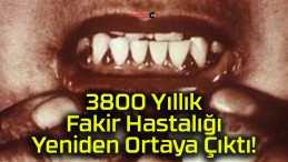 3800 Yıllık Fakir Hastalığı Yeniden Ortaya Çıktı!