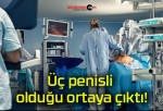 Üç penisli olduğu ortaya çıktı!