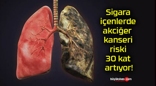 Sigara içenlerde akciğer kanseri riski 30 kat artıyor!