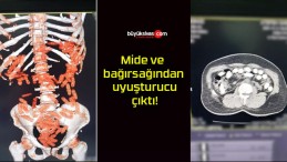 Mide ve bağırsağından uyuşturucu çıktı!