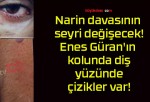 Narin davasının seyri değişecek! Enes Güran’ın kolunda diş, yüzünde çizikler var!