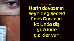 Narin davasının seyri değişecek! Enes Güran’ın kolunda diş, yüzünde çizikler var!