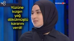 Yüzüne kızgın yağ dökülmüştü kararını verdi!