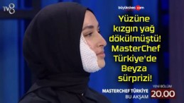 Yüzüne kızgın yağ dökülmüştü! MasterChef Türkiye’de Beyza sürprizi!