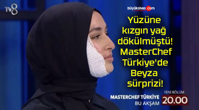 Yüzüne kızgın yağ dökülmüştü! MasterChef Türkiye’de Beyza sürprizi!