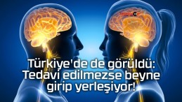 Türkiye’de de görüldü: Tedavi edilmezse beyne girip yerleşiyor!