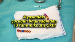 4 yaşındaki çocuğun bağırsağından 13 tane mıknatıs çıktı!