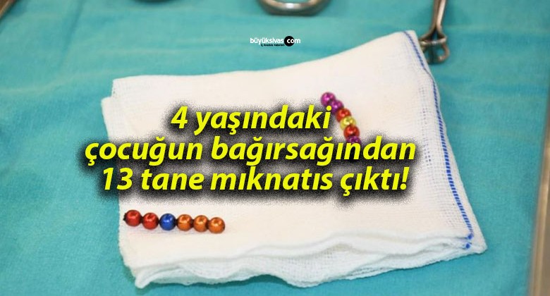 4 yaşındaki çocuğun bağırsağından 13 tane mıknatıs çıktı!