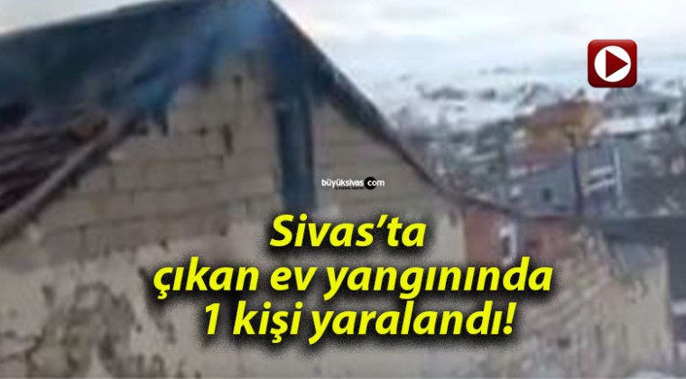 Sivas’ta çıkan ev yangınında 1 kişi yaralandı!