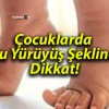 Çocuklarda Bu Yürüyüş Şekline Dikkat!