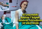 65 yaşındaki kadına 7 köpek saldırdı; vücuduna 50 dikiş atıldı