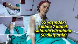 65 yaşındaki kadına 7 köpek saldırdı; vücuduna 50 dikiş atıldı