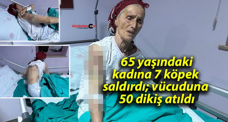 65 yaşındaki kadına 7 köpek saldırdı; vücuduna 50 dikiş atıldı