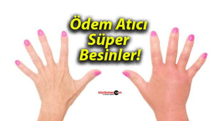 Ödem Atıcı Süper Besinler!