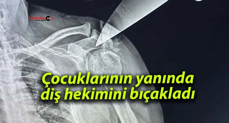 Çocuklarının yanında diş hekimini bıçakladı